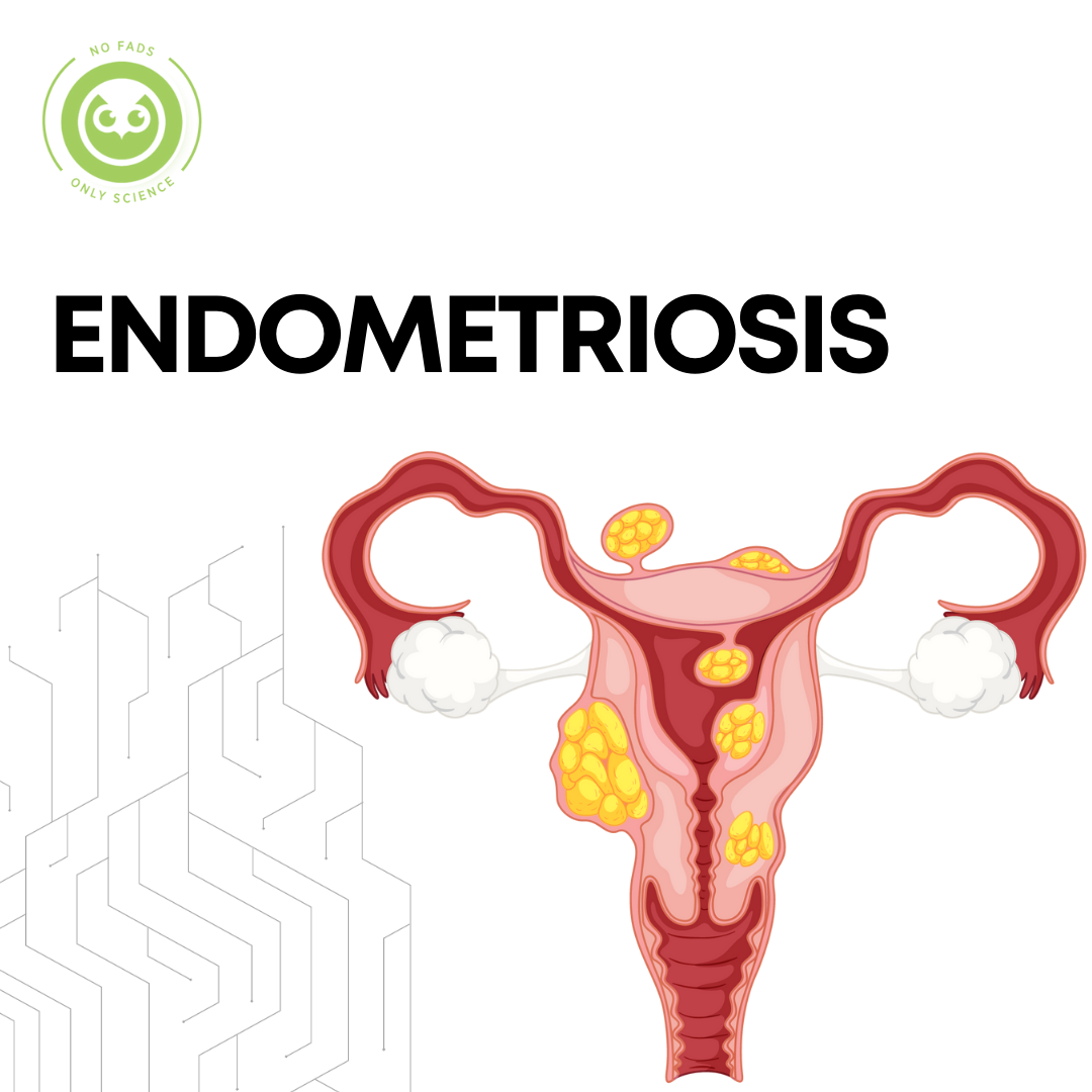 Endometriosis | pcos